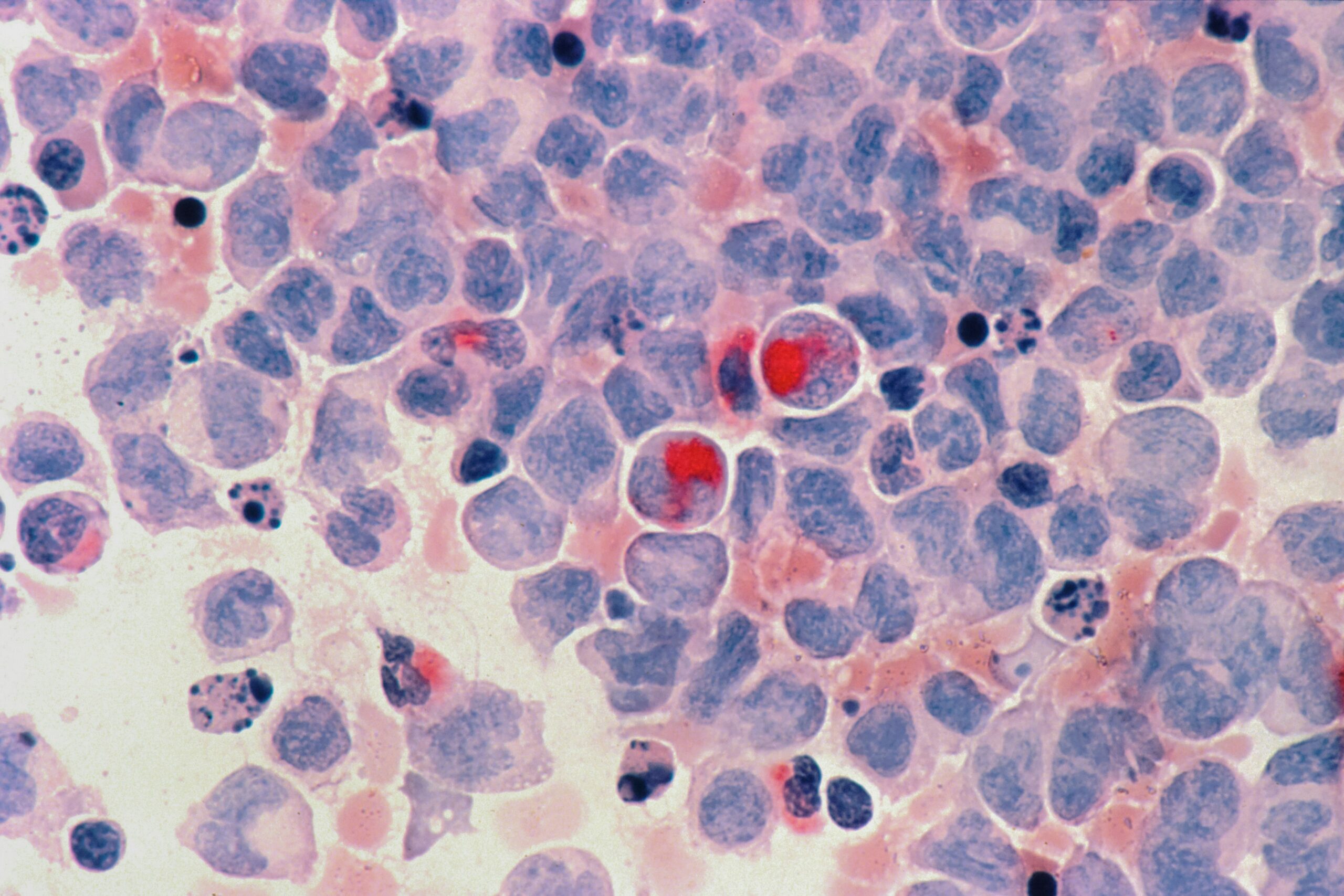Google DeepMind Makes Breakthrough in Cancer Treatment Using AI
